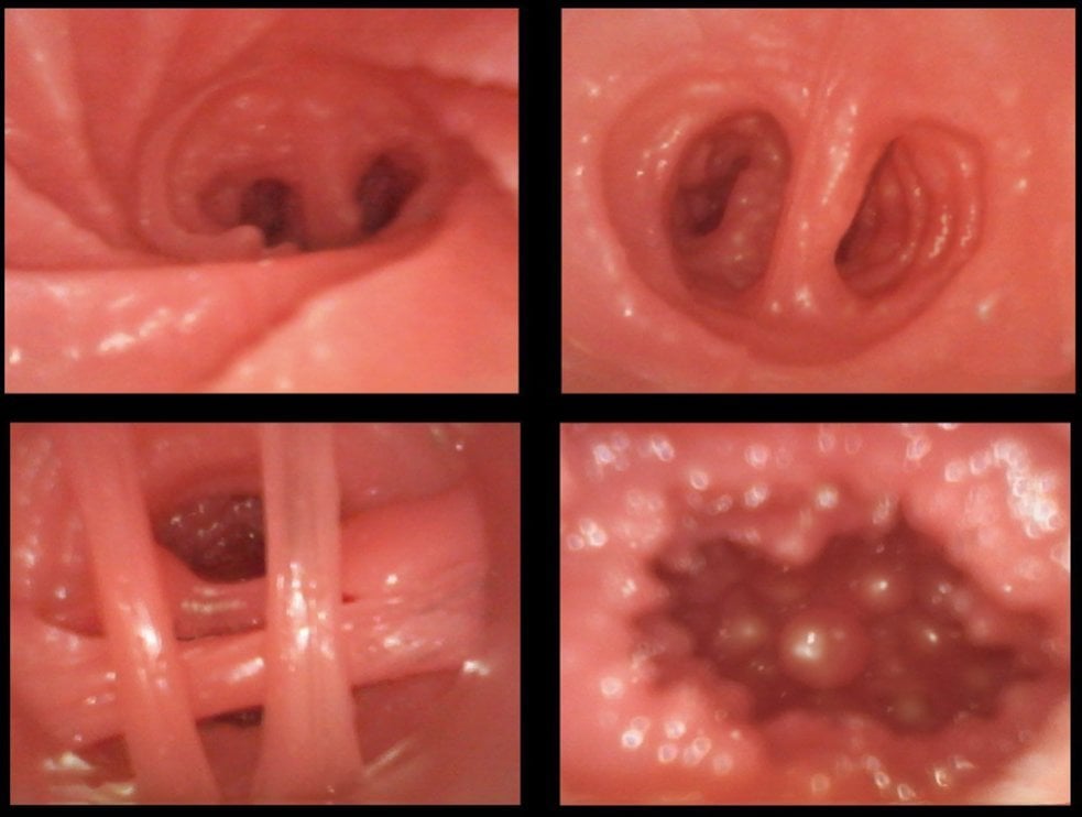 Hidachitsukko PLUS DX Internal Hole 3 