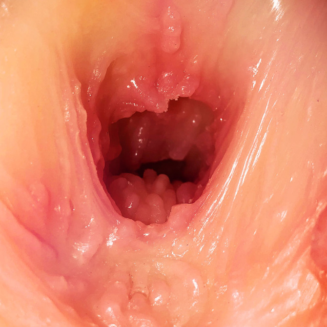 Vagina Interior